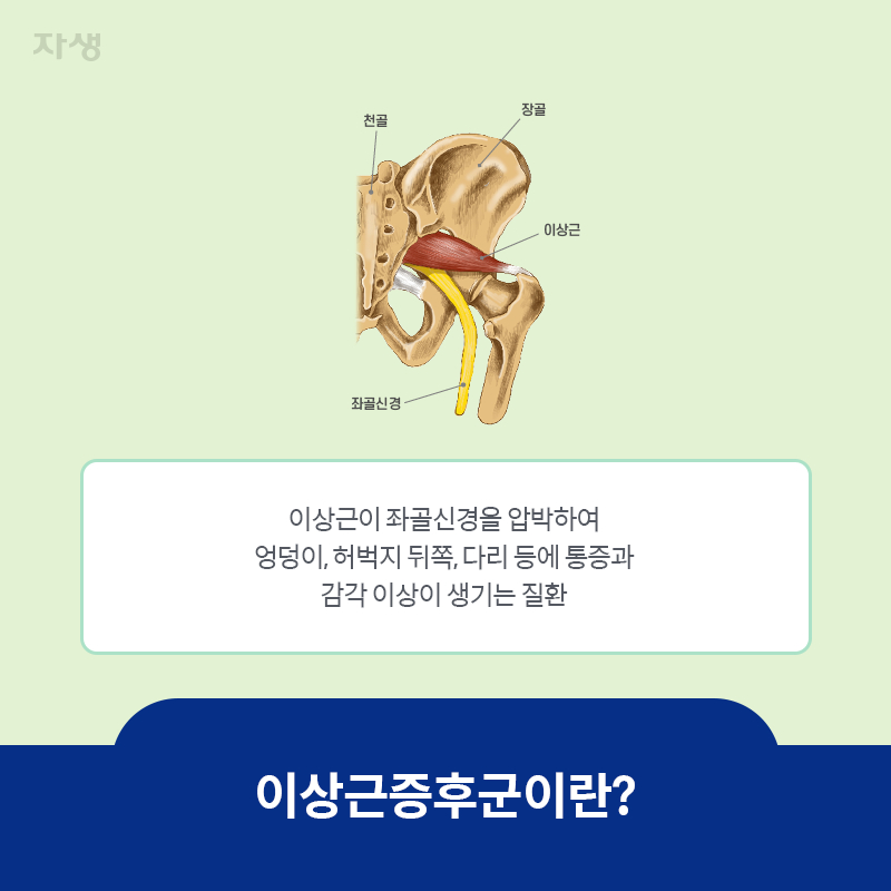 참고 이미지 : 이상근증후군이란? | 자생한방병원·자생의료재단