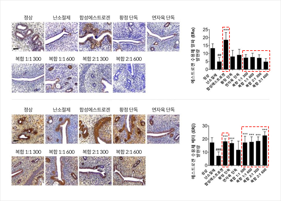 황정∙연자육 복합 투여군은 대조군들에 비해 ERα 발현을 억제하고 ERβ 발현을 촉진하는 것으로 나타났다 | 자생한방병원・자생의료재단