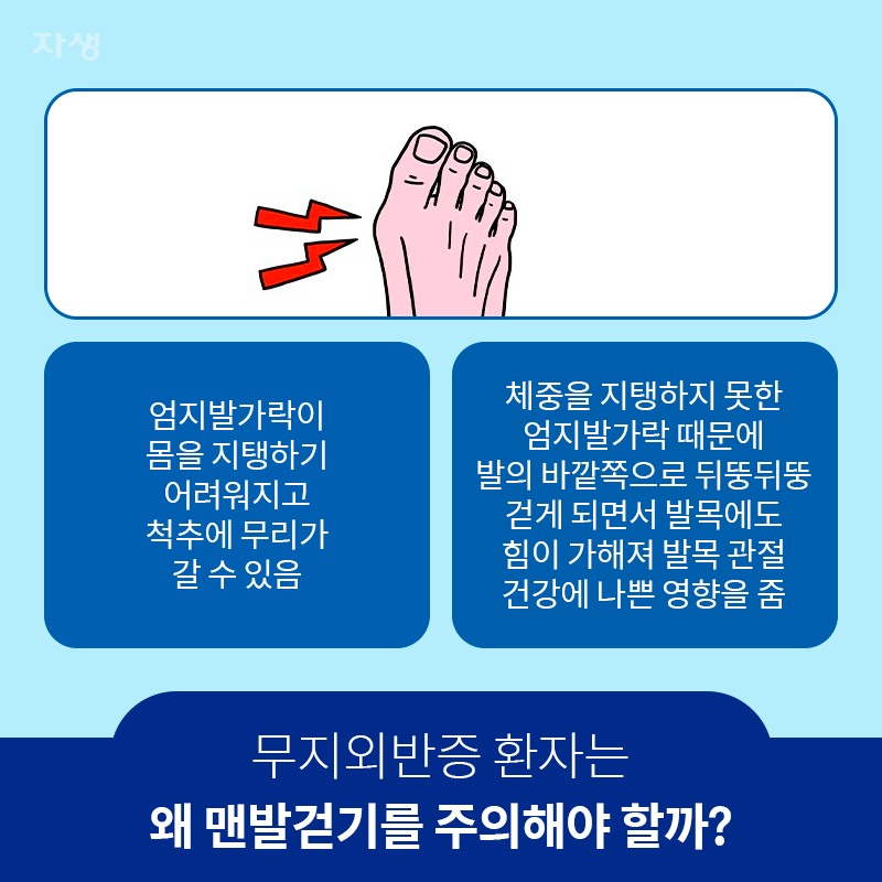 무지외반증 환자는 왜 맨발걷기를 주의해야 할까?