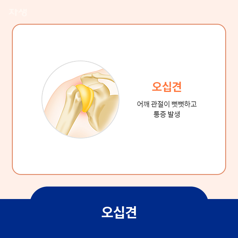 오십견 발생 위치 표시한 이미지로 오십견은 어깨 관절이 뻣뻣하고 통증 발생함.