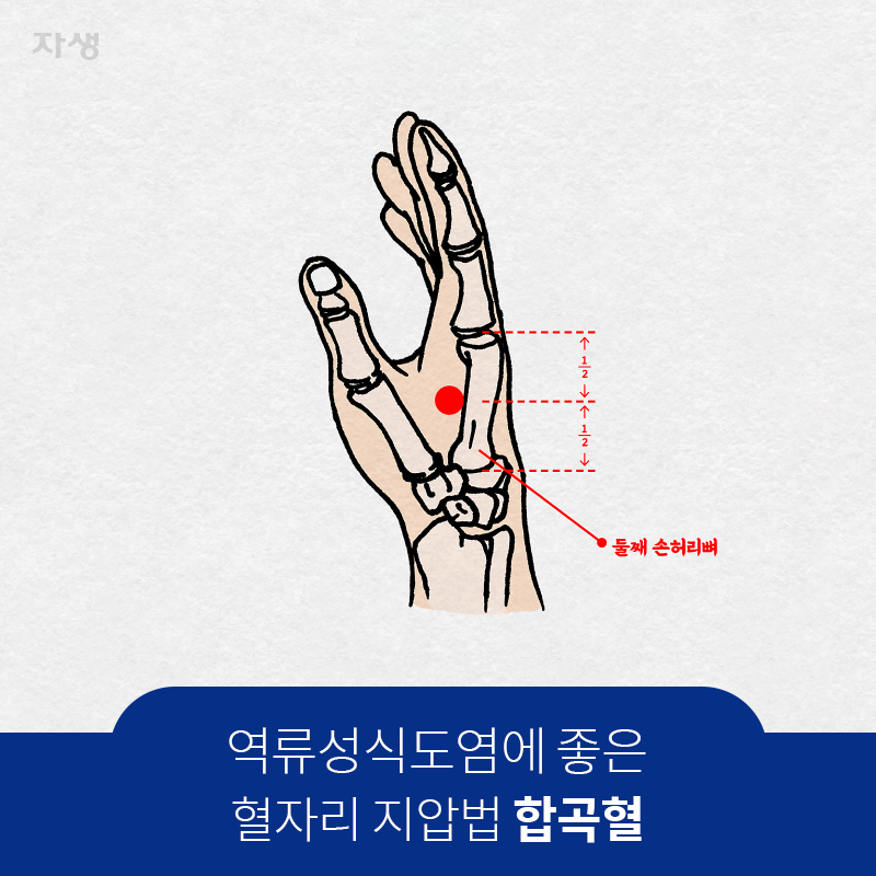 참고 이미지 : 역류성식도염에 좋은 혈자리 지압법 합곡혈 | 자생한방병원·자생의료재단