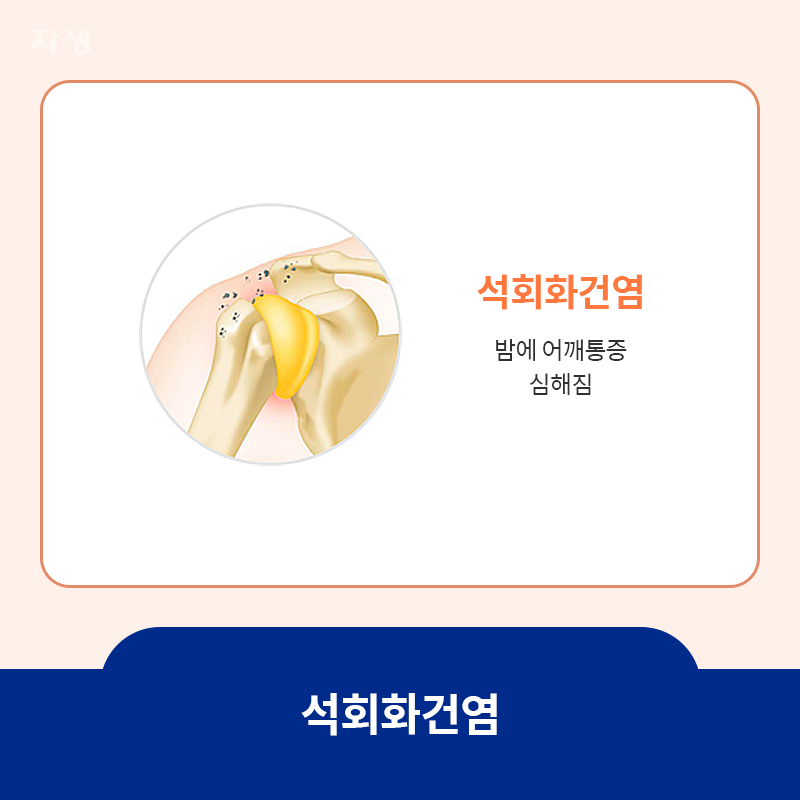 석회화건염 위치 표시 이미지로 석회화건염은 밤에 어깨통증이 심해짐