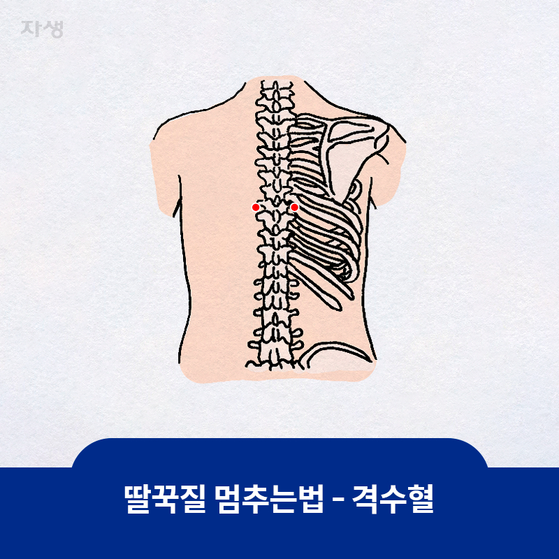 타이틀 이미지 : 딸꾹질 멈추는법 - 격수혈