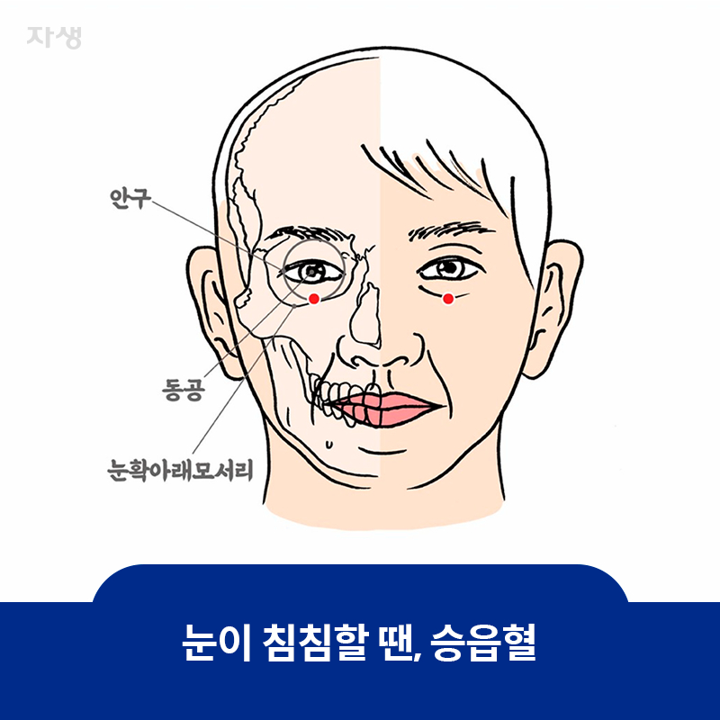 눈이 침침할 때 누르면 좋은 승읍혈 혈자리 위치 표시