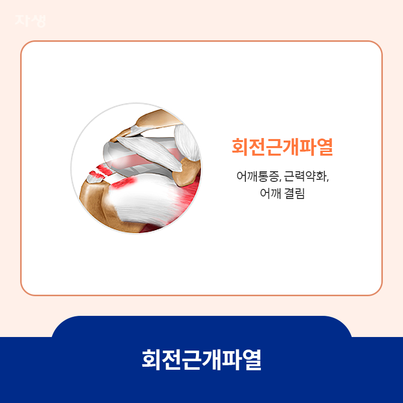 회전근개파열 위치 표시 이미지