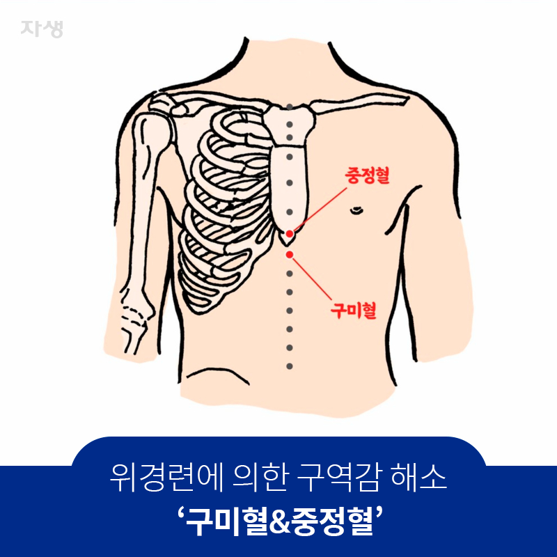 위경련 구역감 해소에 좋은 구미혈&중정혈 위치 표시